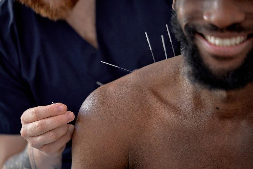 Homem sorrindo fazendo acupuntura